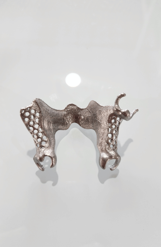 3D printed metal dental framework